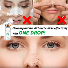 Load image into Gallery viewer, Blackhead Out Night Serum™