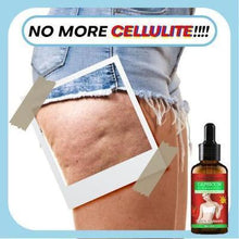 Load image into Gallery viewer, Anti-Cellulite Oil™