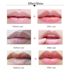 Load image into Gallery viewer, 24K Gold Collagen Lip Mask™ (5 Pieces)