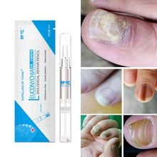 Load image into Gallery viewer, Anti-Fungal Natural Nail Treatment Pen