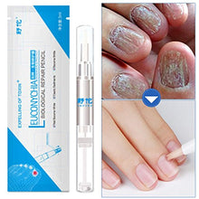Load image into Gallery viewer, Anti-Fungal Natural Nail Treatment Pen
