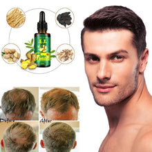 Load image into Gallery viewer, ReGrow™ 7 Day Ginger Hair Serum
